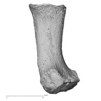 metatarsal first right