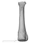metatarsal fourth right