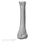 metatarsal second right