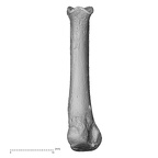 metatarsal third right
