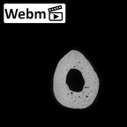 NH MER35 135 Gorilla gorilla gorilla metatarsal fifth right ct stack movie