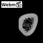 NH MER35 135 Gorilla gorilla gorilla metatarsal first right ct stack movie