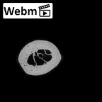 NH MER35 135 Gorilla gorilla gorilla metatarsal fourth right ct stack movie