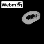 NH MER35 135 Gorilla gorilla gorilla metatarsal third right ct stack movie