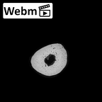 NH MER36 264 Gorilla gorilla gorilla metatarsal fifth right ct stack movie