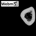 NH MER36 264 Gorilla gorilla gorilla metatarsal first right ct stack movie