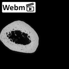 NH MER36 264 Gorilla gorilla gorilla metatarsal fourth right ct stack movie