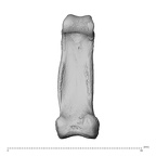 hand phalanx fifth proximal left