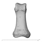 hand phalanx first proximal left