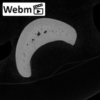 NH CAM1 230 Gorilla gorilla gorilla hand phalanx fourth proximal left ct stack movie