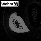 NH MER30 29 Gorilla gorilla gorilla hand phalanx fifth proximal right ct stack movie