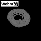 NH MER30 29 Gorilla gorilla gorilla hand phalanx first proximal right ct stack movie