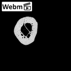 NH MER30 29 Gorilla gorilla gorilla metacarpal fifth right ct stack movie