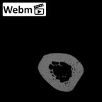 NH MER30 29 Gorilla gorilla gorilla metacarpal fourth right ct stack movie