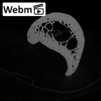 NH MER32 300 Gorilla gorilla gorilla hand phalanx fifth proximal right ct stack movie