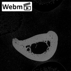 NH MER32 300 Gorilla gorilla gorilla hand phalanx second proximal right ct stack movie
