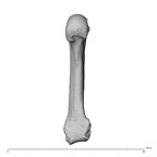 metacarpal fifth right