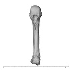 metacarpal fourth right