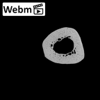 NH MER32 300 Gorilla gorilla gorilla metacarpal third right ct stack movie