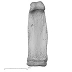 hand phalanx fifth proximal left