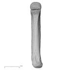 metacarpal fifth left