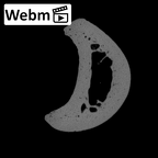 PC MER32 372 Gorilla gorilla gorilla hand phalanx fourth proximal right ct stack movie
