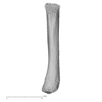 metacarpal fifth right
