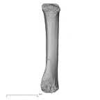 metacarpal second right