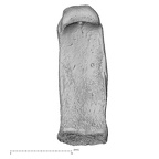 hand phalanx fifth proximal right