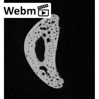 NH MER32 690 Gorilla gorilla gorilla hand phalanx fifth proximal right ct stack movie