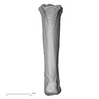 metacarpal fourth right