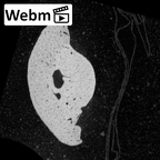 NH MER32 696 Gorilla gorilla gorilla hand phalanx fifth middle right ct stack movie