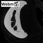 NH MER32 696 Gorilla gorilla gorilla hand phalanx fourth proximal right ct stack movie