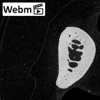 NH MER32 696 Gorilla gorilla gorilla metacarpal first right ct stack movie