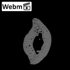 NH MER32 962 Gorilla gorilla gorilla hand phalanx fifth middle right ct stack movie