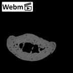 NH MER32 962 Gorilla gorilla gorilla hand phalanx second middle right ct stack movie