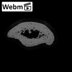 NH MER32 962 Gorilla gorilla gorilla hand phalanx third middle right ct stack movie