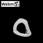 NH MER32 962 Gorilla gorilla gorilla metacarpal fifth right ct stack movie