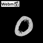 NH MER32 962 Gorilla gorilla gorilla metacarpal first right ct stack movie
