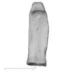 hand phalanx fifth proximal right