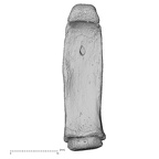 hand phalanx fourth proximal right