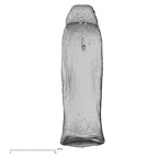 hand phalanx third proximal right