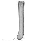 metacarpal fifth right