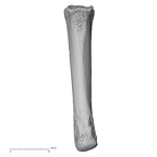 metacarpal fourth right