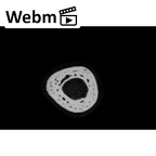 NH MER33 409 Gorilla gorilla ssp. metacarpal fourth right ct stack movie