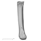 metacarpal second right