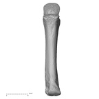 metacarpal third right