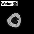 NH MER33 409 Gorilla gorilla ssp. metacarpal third right ct stack movie
