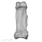 hand phalanx fifth proximal right
