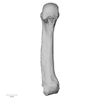 metacarpal fifth right